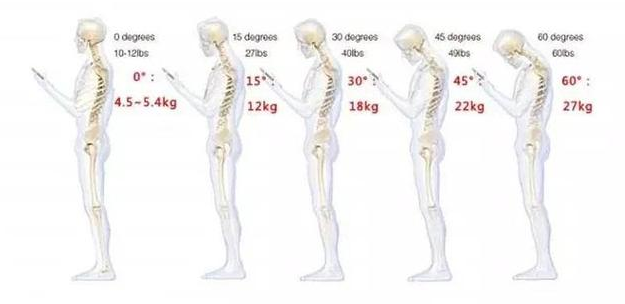 “防低头神器”火了 真的可以拯救“低头族”的脖子吗？